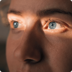 Generalized Pustular Psoriasis flares are unpredictable